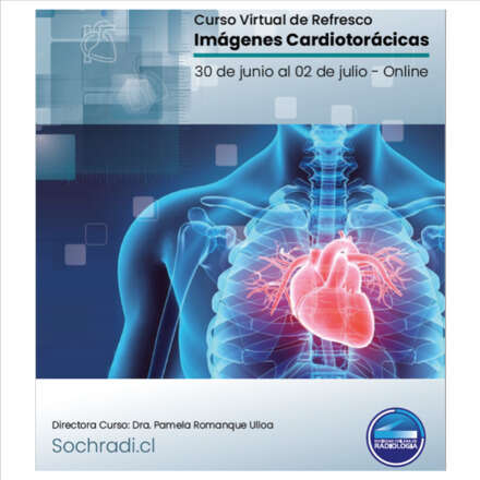 Curso Virtual de Refresco Imágenes Cardiotorácicas