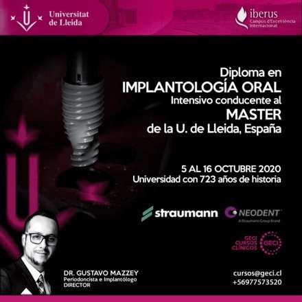 Diplomado Experto en Implantología Oral Universidad de Lleida (Teoría Online + Clínica en Chile)