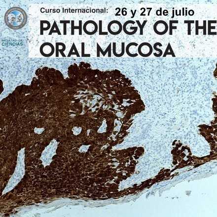 Congreso Internacional: Pathology of the Oral Mucosa - Dra. Sook Bin Woo en Chile