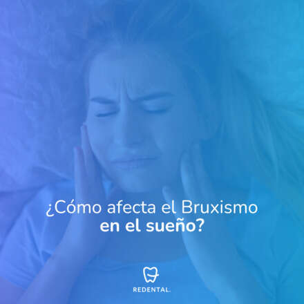 ¿Cómo afecta el Bruxismo en el sueño?